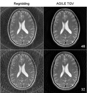 AGILE: GPU Image Reconstruction Library • Center for Advanced Imaging ...