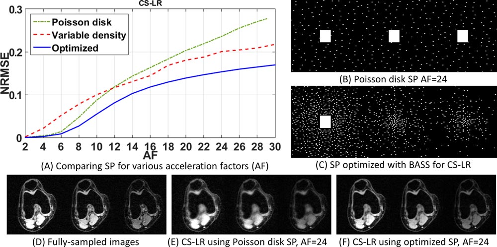 An illustration of results obtained through bias-accelerated subset selection for optimizing the sampling pattern in accelerated MRI.