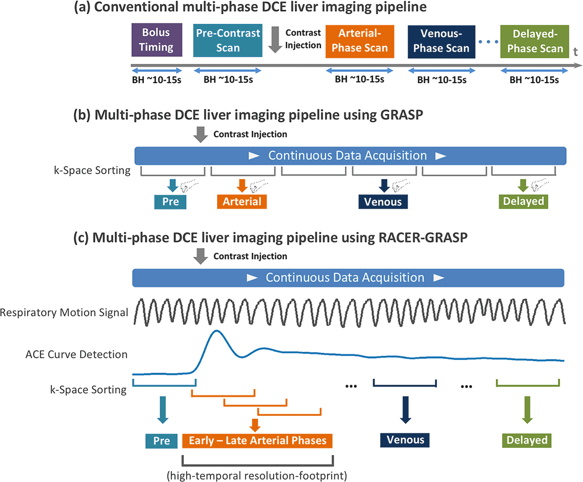 A comparison of dynamic contrast enhanced (DCE) workflows for liver MRI.