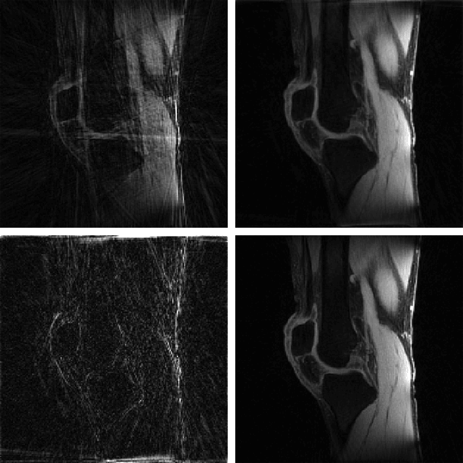 Examples NUFFT and MFISTA image reconstructions from undersampled MRI data, NUFFT reconstruction from fully sampled data, and comparison between the fully sampled NUFFT and undersampled MFISTA-VA reconstruction.