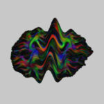 Illustration of Gibbs ringing, an artifact that often affects diffusion MR images.
