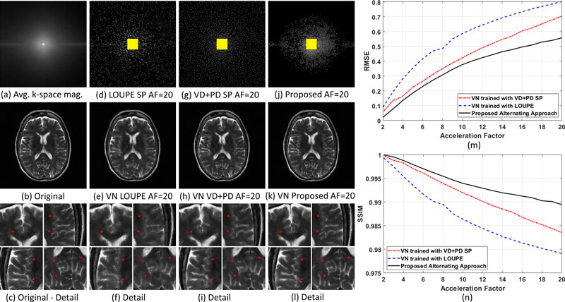 Comparison of sampling patterns and reconstructed images at twenty-fold acceleration; Graphs plotting root mean square error and structural similarity index measure against acceleration factors.