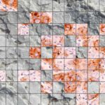 Illustration showing salt crystals and ductal carcinoma tissue.