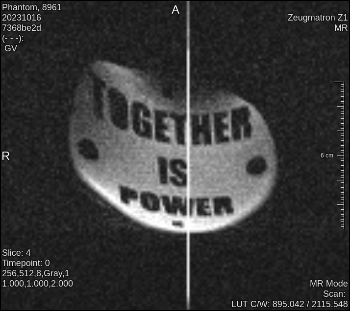 Magnetic resonance image of the hackathon phantom.