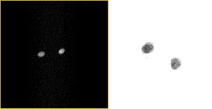 MRI obtained with the Zeugmatron juxtaposed with the "zeugmatogram"  made by Paul Laterbur.