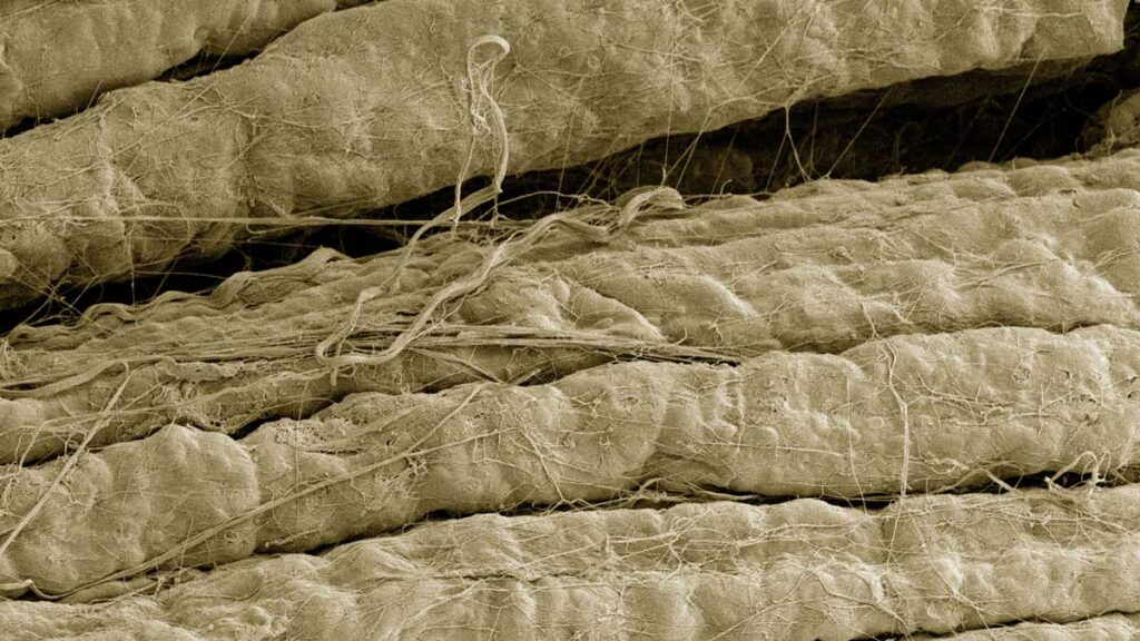 Photo: myelinated axons
