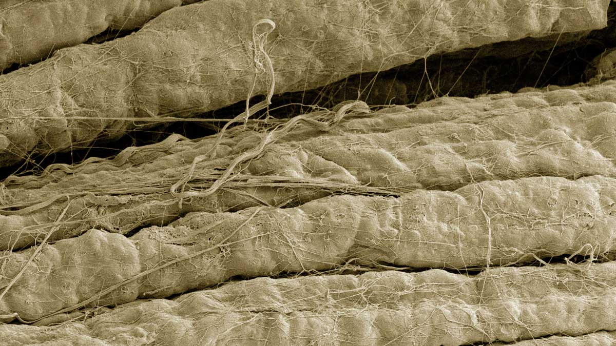 Photo: myelinated axons