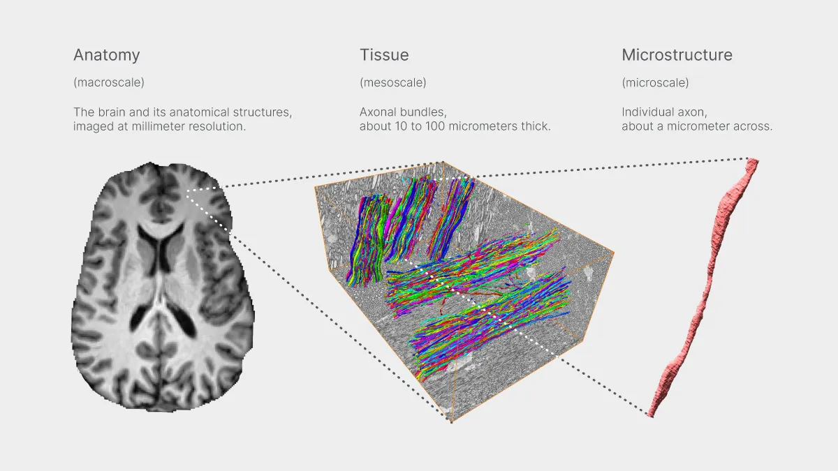 Illustration: three panels showing brain structures at progressively smaller scales: whole-brain anatomy at millimeter resolution; axonal bundles at the mesoscale (10-100 microns); and an individual axon, about one micron thick.