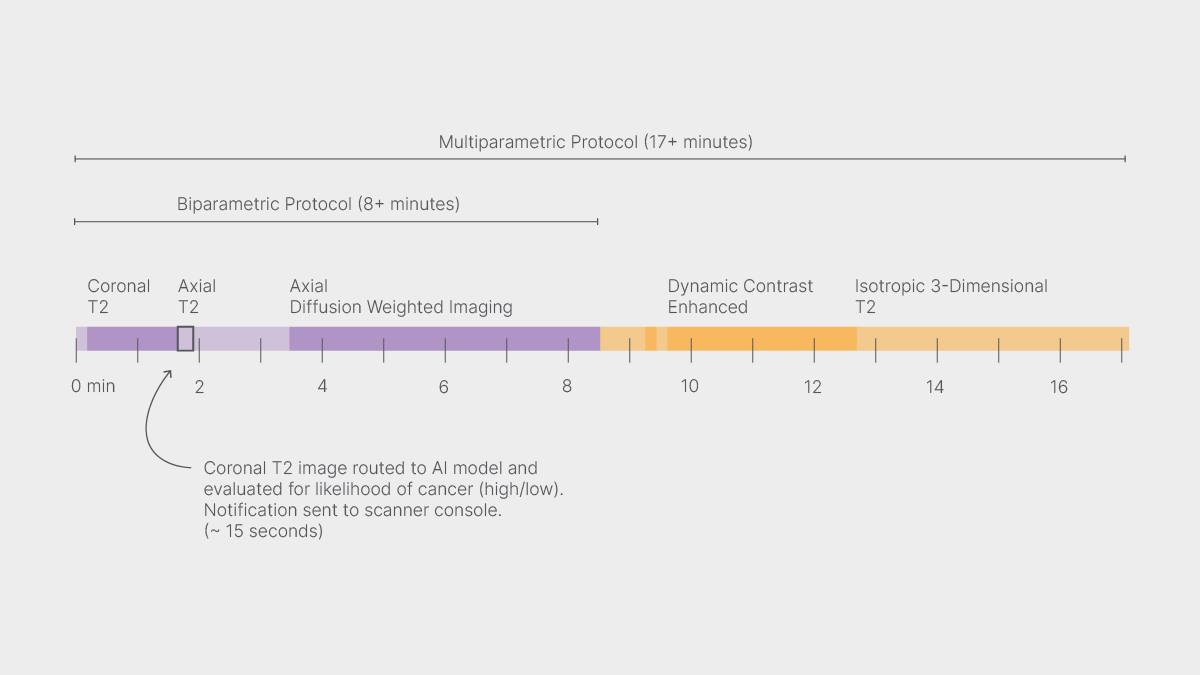 A simplified, annotated timeline of abbreviated and multiparametric MRI protocols.