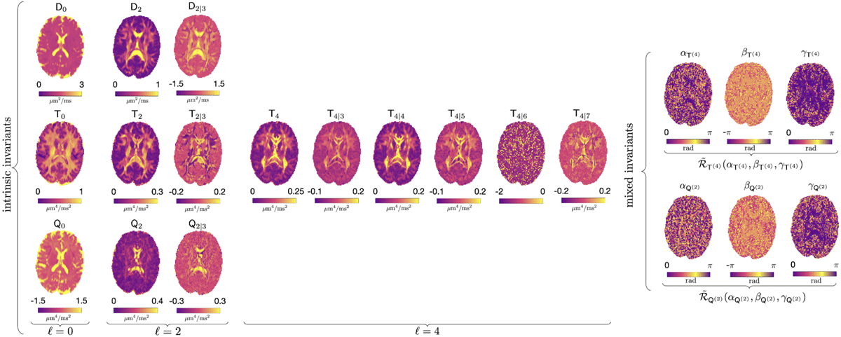 Table of axial diffusion brain images showing 21 contrasts obtained by combining LTE and PTE O(b2) signals.