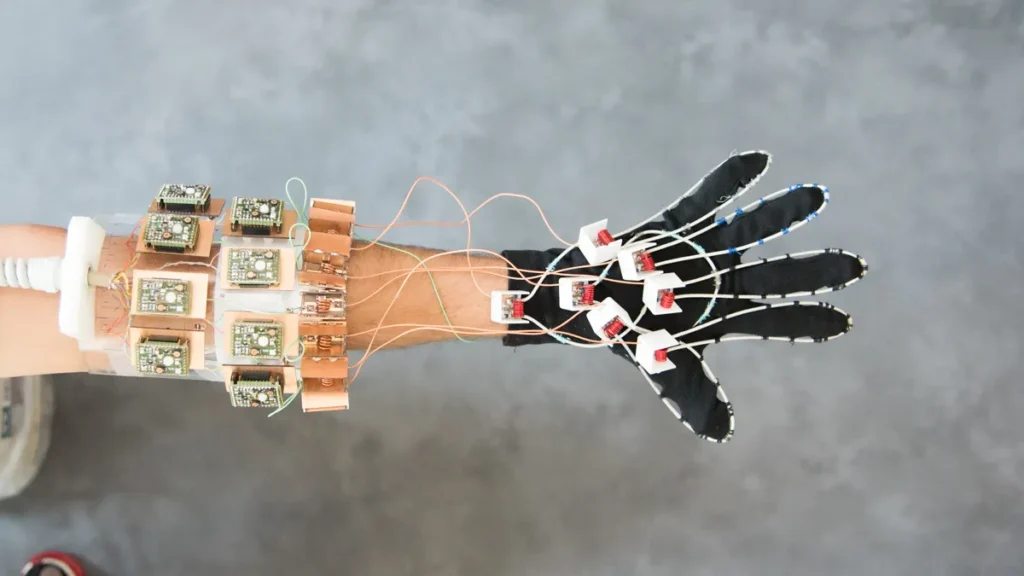 Glove coil worn on an arm. Photo by Pawel Slabiak/NYU Langone Health.