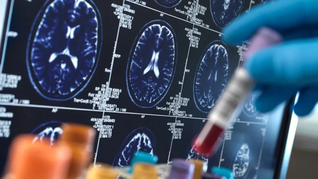 Photo: brain scans on a screen.