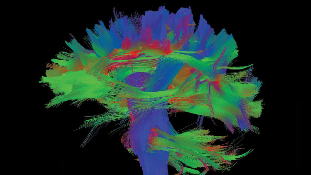 Tractogram of the brain.