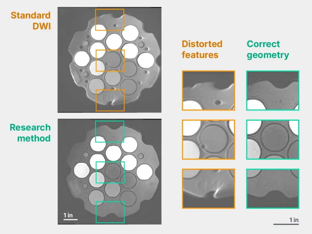 Illustration: comparison of phantom images taken with standard DWI and a research method, with several areas of detail magnified.