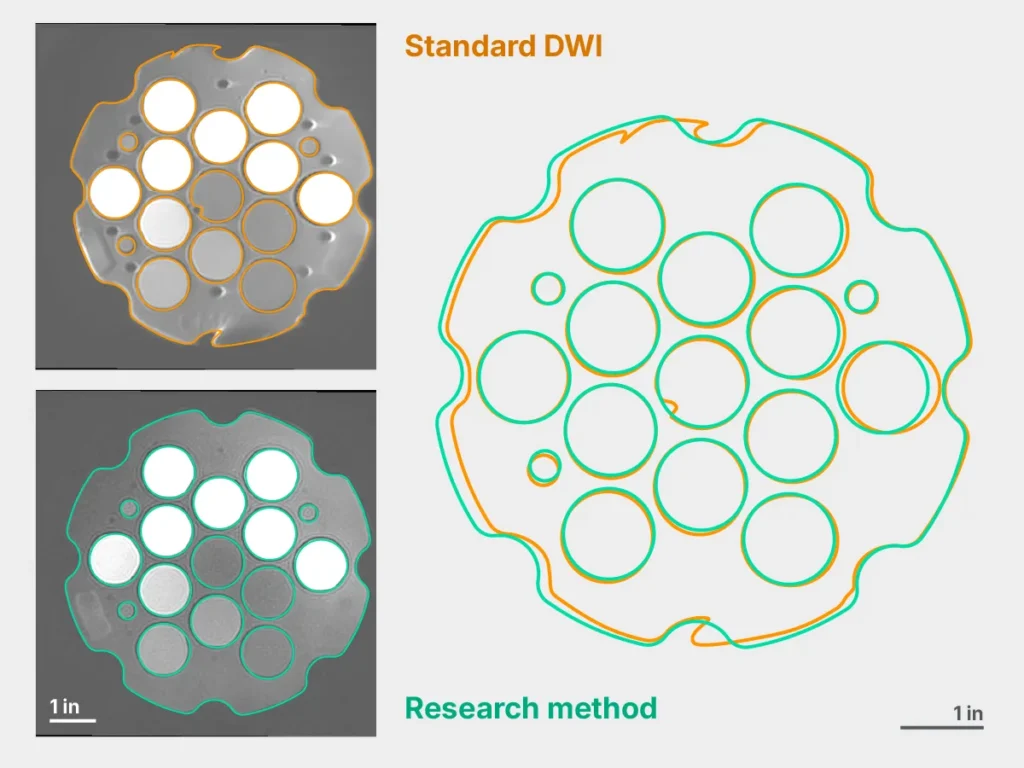 Illustration: comparison of phantom images taken with standard DWI and a research method.